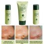 Набор от черных точек на основе экстракта зеленого чая BIOAQUA green tea blackhead